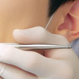 수성구치과 충치 인레이 치료, 언제 고려해야 할까요? 관련 사진 17