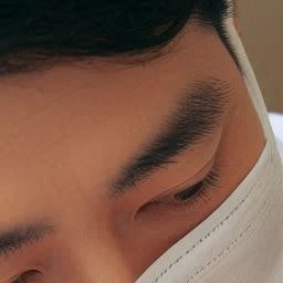 수성구치과 충치 인레이 치료, 언제 고려해야 할까요? 관련 사진 7
